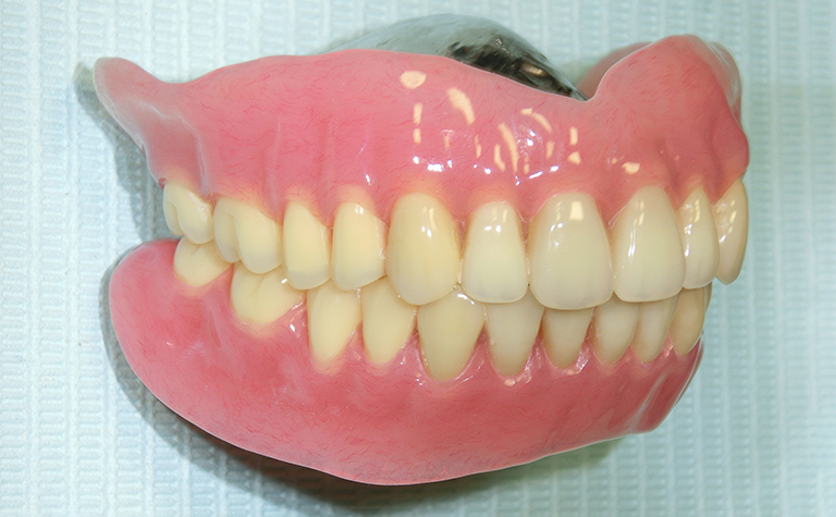 総義歯2
